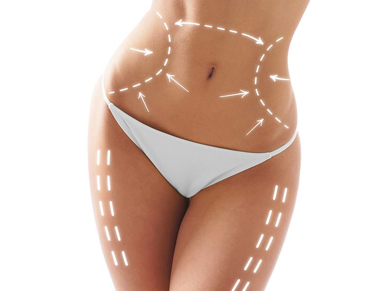 Trattamento per Cellulite