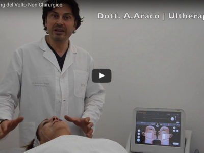 Video Ultherapy Lifting volto non chirurgico