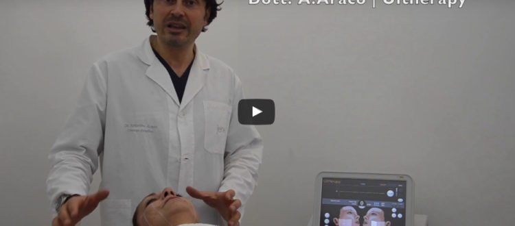 Video Ultherapy Lifting volto non chirurgico