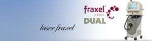 Fraxel Laser Milano Roma