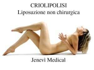 Criolipolisi Roma