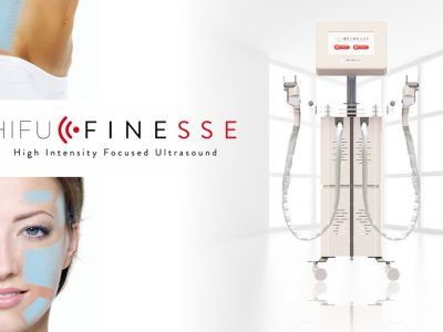 Finesse Ultrasuoni Focalizzati