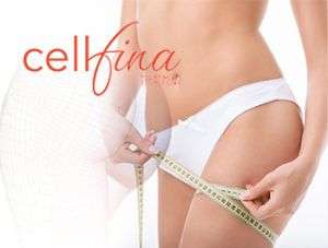 Via la cellulite con Cellfina