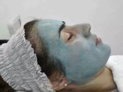 Tca Peeling per Macchie del volto e Melasma