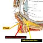 Complicanza da filler nella regione orbitaria &#8211; come evitarla?