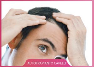 Cellule staminali e crescita capelli - Roma