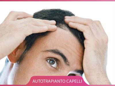 Ricrescita dei capelli con il PRP – Milano