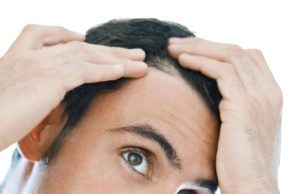 Terapia follicolare per alopecia