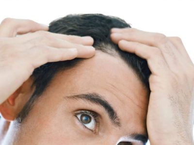 Terapia follicolare per alopecia