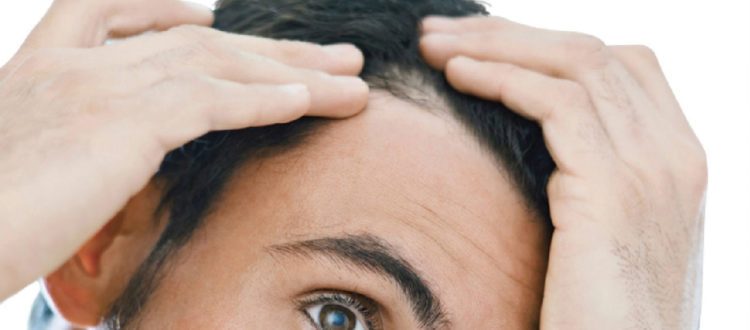 Terapia follicolare per alopecia